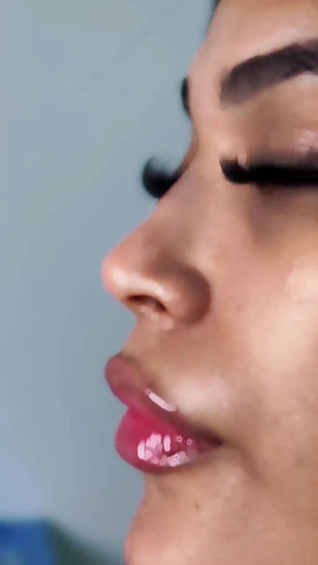 Harmonização facial não é um procedimento